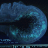 This is someone dying while having an MRI scan.