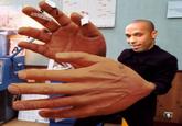 Hand of Henry