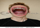 Awkward Stock Photos
