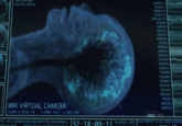 This is someone dying while having an MRI scan.