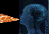 This is someone dying while having an MRI scan.