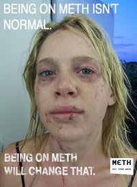 X isn't normal, but on Meth it is