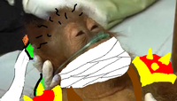 Dying Orangutan