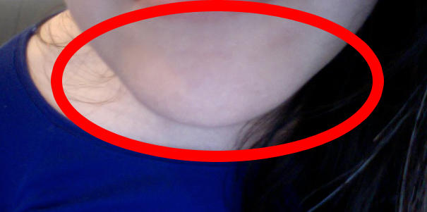 chin.jpg